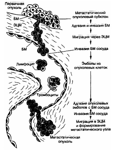 Метастатический каскад. Опухоли