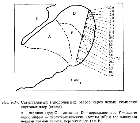 сагиттальный разрез через левый компллекс слуховых ядер