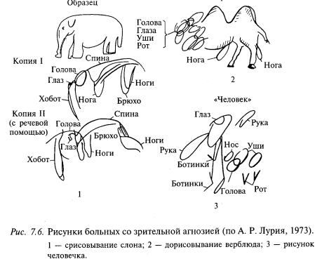 рисунки больных со зрительной агнозией