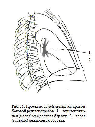 проекия долей легких на правой боковой рентгенограмме