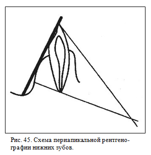 Периапикальная рентгенография нижних зубов