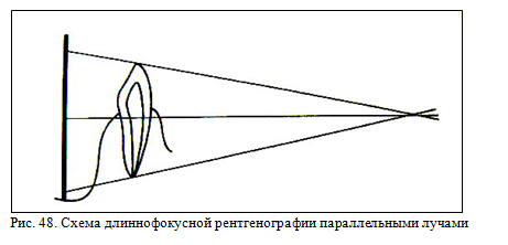 Длиннофокусная рентгенография параллельными лучами зубов