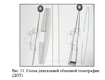 Дентальная объемная томография