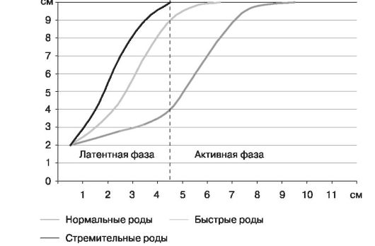 Партограммы при бурной родовой