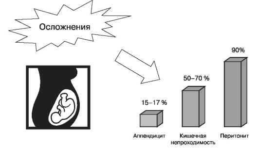 Риск развития осложнений беременности при острых заболеваниях брюшной полости
