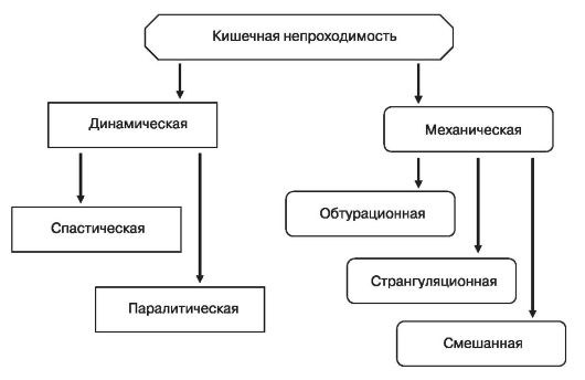 Виды кишечной непроходимости