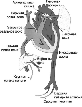 Система кровообращения новорожденного (стрелками указано направление движения крови)