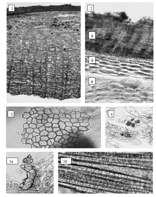 Крушины ольховидной кора. микроскопия