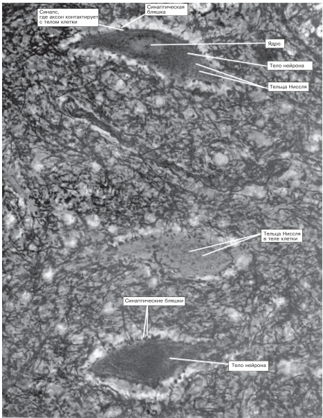 Клеточные тела нейронов с синапсами и тельцами Ниссля.